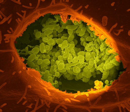 Los topillos también están implicados en la transmisión de la fiebre Q