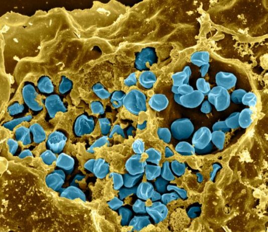 El 92,9% de casos nacionales de tularemia de 2019 tuvieron su origen en Palencia