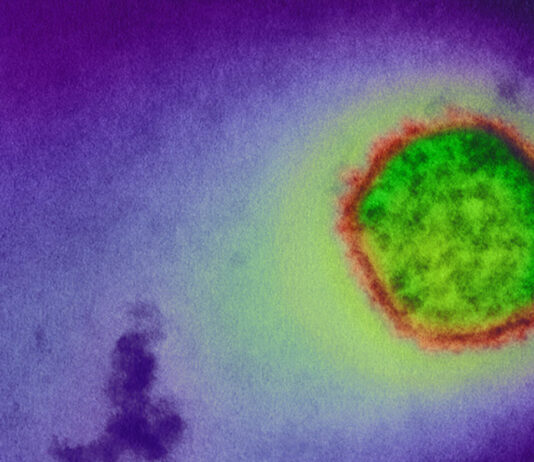 Detectan hantavirus en los topillos