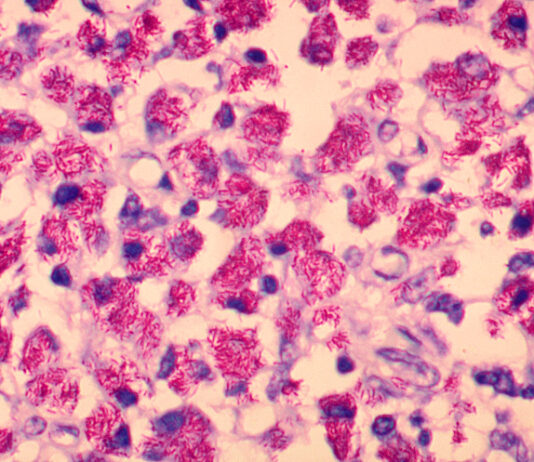 Científicos desarrollan una vacuna contra la paratuberculosis de los rumiantes